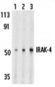 Anti-IRAK4