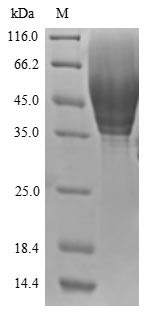 CD63 antigen (CD63), partial, human, recombinant