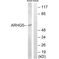 Anti-ARHGEF5