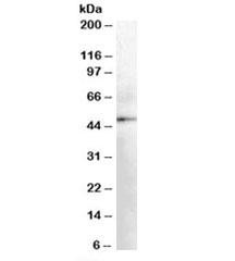 Anti-DOPA decarboxylase