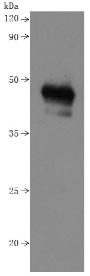 B-lymphocyte antigen CD20 (MS4A1)-VLPs (Active), human, recombinant