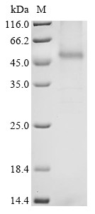 C-C chemokine receptor-like 2 (CCRL2), human, recombinant