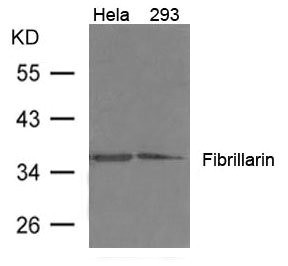 Anti-FBL