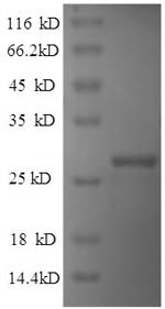 Indian hedgehog protein (IHH), partial, human, recombinant