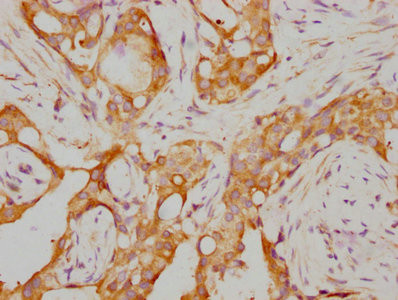 Anti-RARA Recombinant Monoclonal, clone 4A10