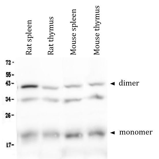 Anti-CD268 / BAFF R