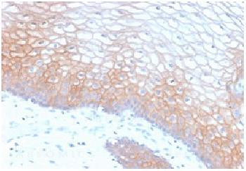 Anti-E-Cadherin (CDH1) / CD324 (Intercellular Junction Marker) Recombinant Rabbit Monoclonal Antibod