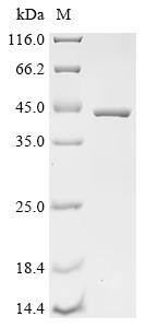 Transcriptional enhancer factor TEF-5 (TEAD3), partial, human, recombinant