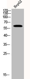 Anti-Phospho-AKT1 (T308)