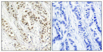 Anti-Phospho-BRCA1 (Ser1524)