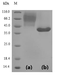 Spike glycoprotein (S), partial (Active), Severe acute respiratory syndrome coronavirus 2, recombina