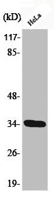 Anti-Phospho-CDK2 (T160)