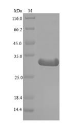 Histone deacetylase complex subunit SAP130 (Sap130), partial, mouse, recombinant