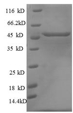 Cellular tumor antigen p53 (Tp53), rat, recombinant