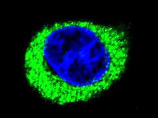 Anti-alpha amylase 2B