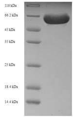 Receptor-interacting serine/threonine-protein kinase 2 (RIPK2), human, recombinant