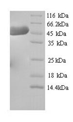 Hydroxymethylglutaryl-CoA synthase, Cytoplasmic domain (Hmgcs1), mouse, recombinant