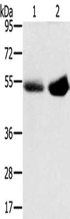 Anti-SLC13A3