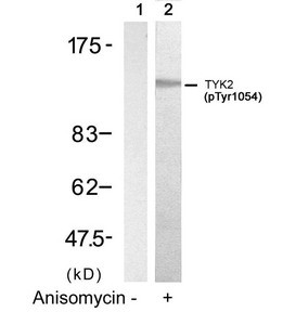 Anti-Phospho-TYK2 (Tyr1054)