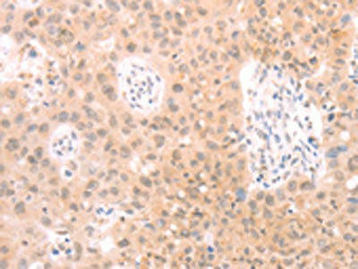 Anti-PKD2L1