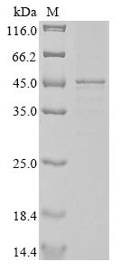 Actin, cytoplasmic 1 (ACTB), human, recombinant