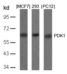 Anti-PDPK1 (Ab-241)