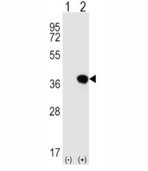 Anti-HLA-G