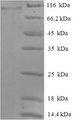 Protein-arginine deiminase type-2 (PADI2), human, recombinant