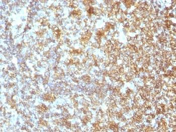 Anti-CD45RA (Leukocyte marker), clone SPM504
