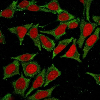 Anti-GSTM2 / Glutathione S-Transferase mu 2, clone CPTC-GSTMu2-2