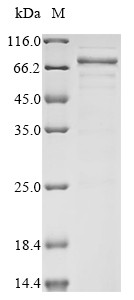 Acetylcholine receptor subunit alpha (CHRNA1), partial, human, recombinant