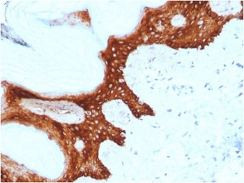 Anti-14-3-3 sigma / SFN, clone CPTC-SFN-2