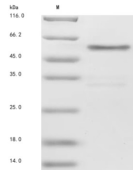 Protein jagged-1 (JAG1), partial, human, recombinant