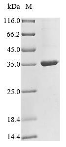 Ceruloplasmin (CP), partial, human, recombinant