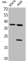 Anti-IFNA1