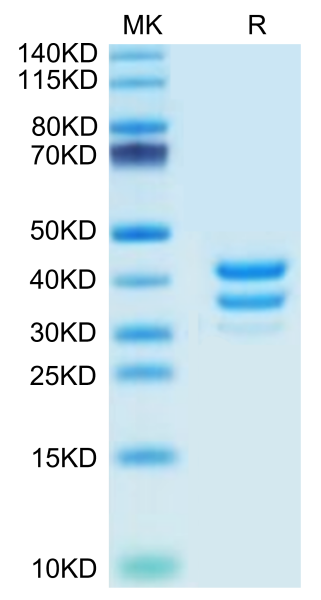 Mouse BAFFR/TNFRSF13C Protein