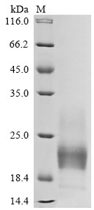 T-cell immunoreceptor with Ig and ITIM domains (TIGIT), partial, human, recombinant