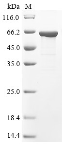 RAC-beta serine/threonine-protein kinase (Akt2), mouse, recombinant