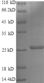 Metalloproteinase inhibitor 4 (TIMP4), partial, human, recombinant