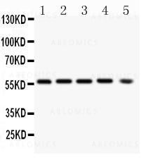 Anti-PKB alpha (Clone: PKB-175)