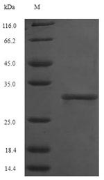 Succinate dehydrogenase [ubiquinone] flavoprotein subunit, mitochondrial (SDHA),partial, human, reco