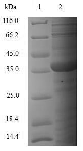 Survival motor neuron protein (Smn1), mouse, recombinant