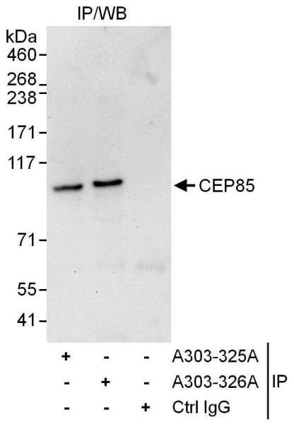 Anti-CEP85