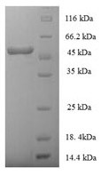 HLA class I histocompatibility antigen, alpha chain E (HLA-E),partial, human, recombinant