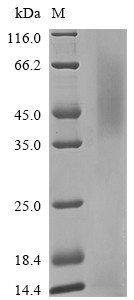 Neuronal acetylcholine receptor subunit alpha-3 (CHRNA3), partial, human, recombinant