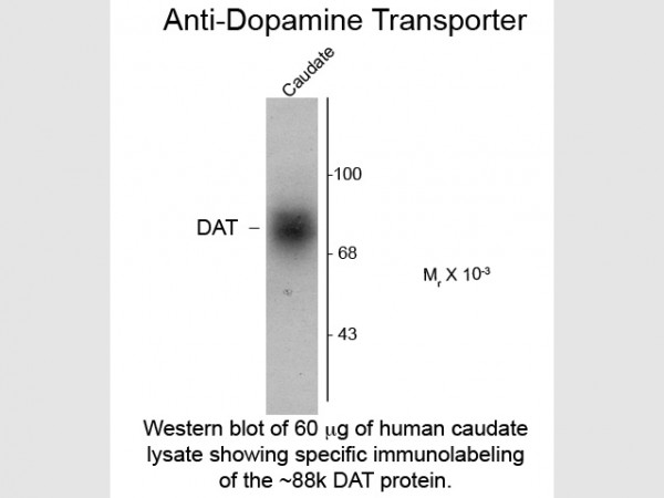 Anti-Dopamine Transporter