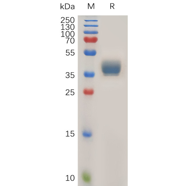 Human CCR1 Protein, hFc Tag