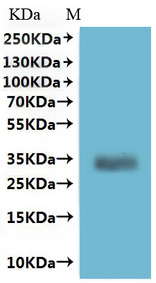 Melanocyte-stimulating hormone receptor (MC1R)-VLPs, human, recombinant