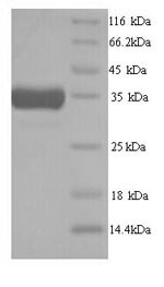 Heme oxygenase 1 (Hmox1), mouse, recombinant