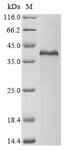 Scavenger receptor cysteine-rich type 1 protein M130 (CD163), partial, human, recombinant